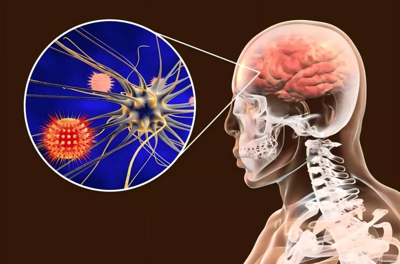 Ghid pentru vaccinul meningococic Ghid pentru vaccinul meningococic